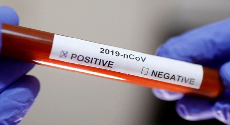 Covid–19: pandemia aumenta e atinge servidores do Judiciário